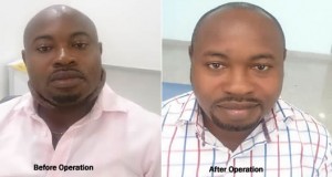 Ibom Specialist Hospital Records Major Surgeries – Info Boss