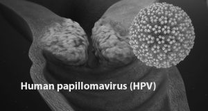 Cervical Cancer: FG Begins Second Phase Of HPV Vaccination In May